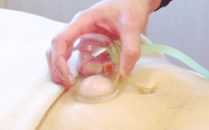 カップドレナージュ