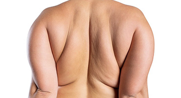 本気痩せ120分 徹底痩身コース！